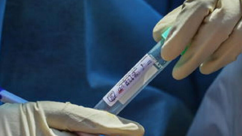 Governo: “I primi di maggio inizieranno i test sierologici”