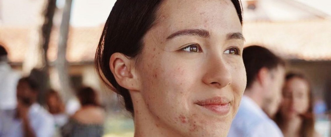 Addio pelle impura e acne: la Teen Beauty degli esperti AIDECO per i ragazzi